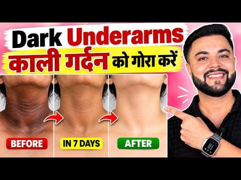 काली गर्दन, Dark Underarms, Inner Thighs & Private Parts का कालापन हटाओ, Rohit Sachdeva on YouTube
